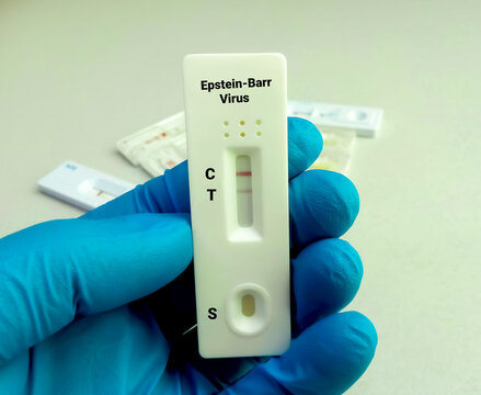Hand hold a device of Epstein-Barr virus (EBV) rapid screening test, showing positive result