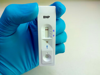 Scientist hold a test device or cassette for BNP test. Rapid screening test, myocardial infraction