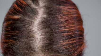 Close-up of a female head parting.