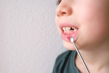 Obraz premium small child, kid 7-8 years old sits with open mouth, teeth close-up, examination of molar by a dentist, concept of dental treatment, bite check