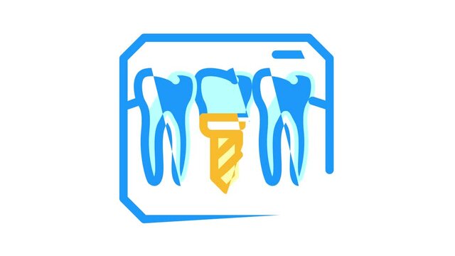 implant check color icon animation
