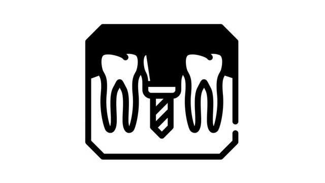 implant check black icon animation