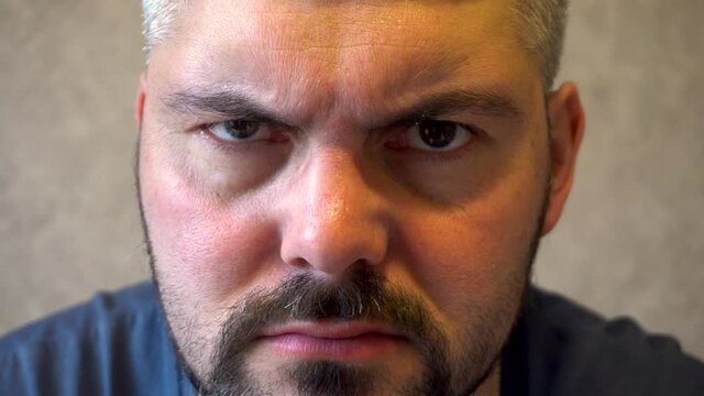 Gloomy man. Bearded face. Grimaces. Winks an eye. Nervous person. Dark hair. European type of face. Part of the head. Close-up.