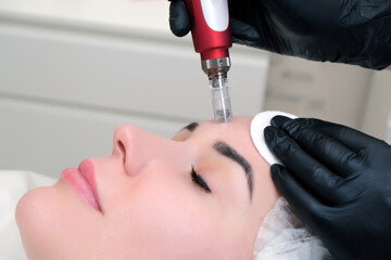 Needle mesotherapy. Cosmetologist performs needle mesotherapy on a womans face.