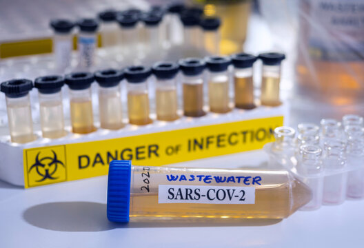  Investigation of sars-cov-2 virus in humans in a wastewater laboratory, conceptual image