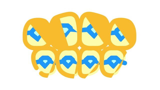 onlays on teeth color icon animation