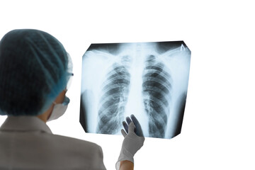 A female doctor or radiologist examines a chest x-ray of a patient in a hospital. Pulmonology and cardiothoracic surgery concept. Control and monitoring of diseases of the lungs and respiratory organs