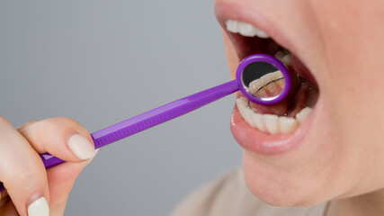 Close-up portrait of a woman with internal braces and a dental mirror. The girl corrects the bite