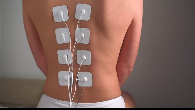 Physiotherapy of the back with TENS electrode pads, external electrical nerve stimulation. Electrodes on the patient's back. 