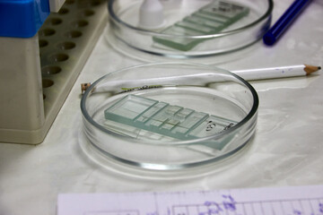 selective focus on Petri dish for taking blood tests in a medical laboratory