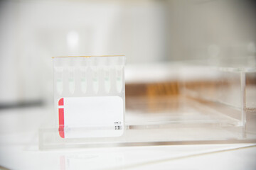 Test tube in laboratory testing.