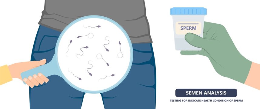 in vitro fertilization IVF semen test sample sperm count type Male biopsy fertility collect Low Poor Zero head anatomy midpiece tail birth control blocked defect abnormal ejaculate vas Non dry