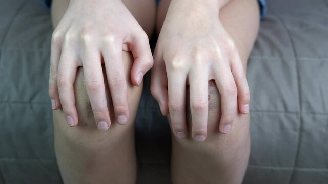 Child abuse. Broken knees of a child.