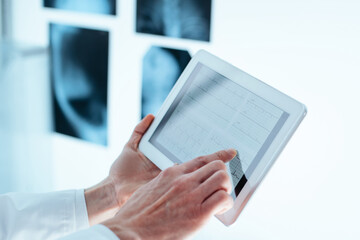 Fototapeta na wymiar doctor with a digital tablet analyzing an X-ray.