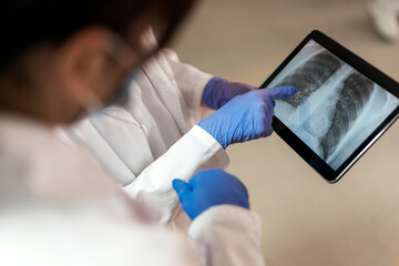 Closeup of Doctors Examining X-Ray