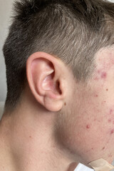 Obraz premium orecchio adolescente capelli 