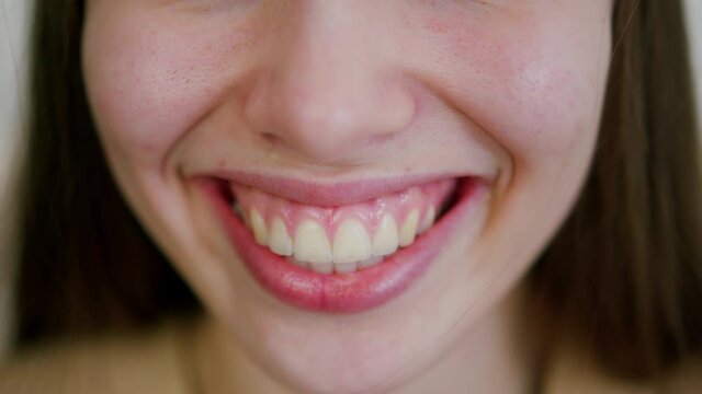 Close up of smiling woman face with perfect smile. Close up mouth woman.