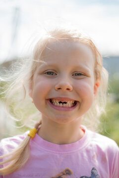 Preschool cute blonde girl with no two front teeth