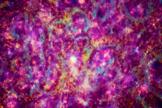 ill human liver cells of biliary cirrhosis