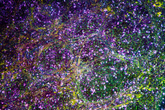 ill human liver cells of biliary cirrhosis