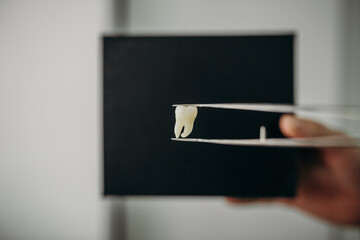 molar tooth figure eight in tweezers