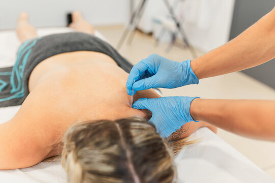 physiotherapist applying an acupuncture session.