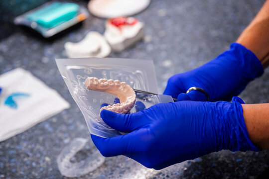 Custom Oral Mouth Mold being made with Plaster
