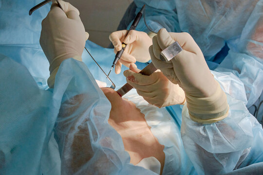 female doctor performs breast augmentation surgery for a woman
