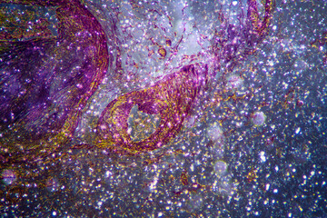micrograph of human coronary artery atherosclerosis cells