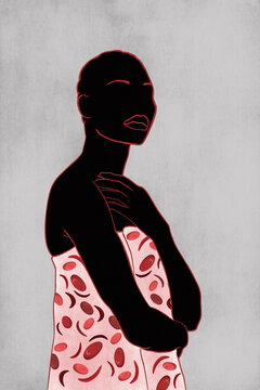 Sickle cell illustration