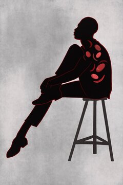 Sickle cell disease illustration.