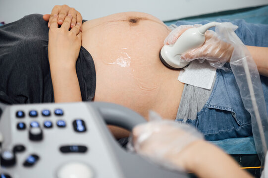 Doctor performing ultrasound on pregnant woman