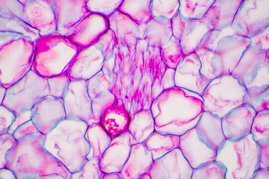 hawthorn fruit micrograph