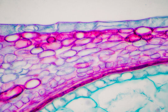 hawthorn fruit micrograph
