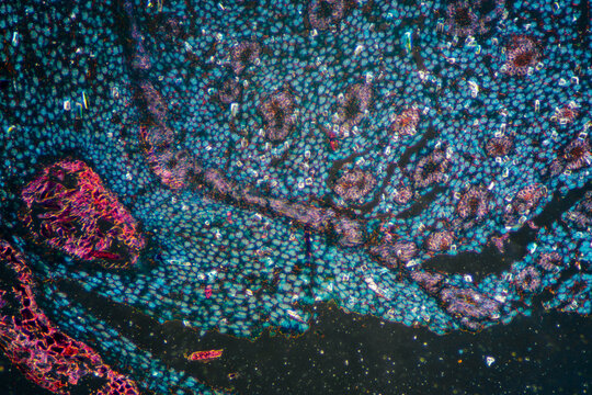 blackberry lily root plant cells micrograph