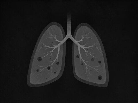 lung disease, pneumonia, asthma, cancer in the form of lung anatomy and viruses, bacteria that cause disease.