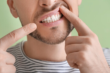 Man suffering from tooth ache on color background, closeup