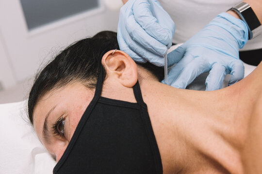 Female patient on a dry needling therapy session
