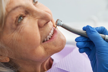 Sharp bur approaching lower tooth of retiree