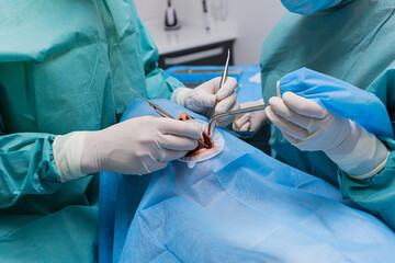 close up a team of dental surgeons performs surgery on a tooth. in a modern dental clinic. Top...