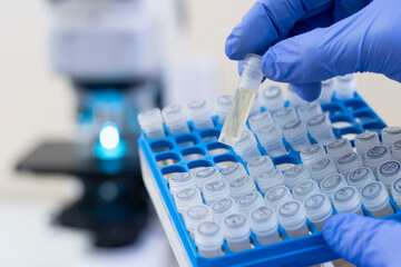 Close-up, a scientist takes out one small test tube of yellow liquid from a tripod against the...