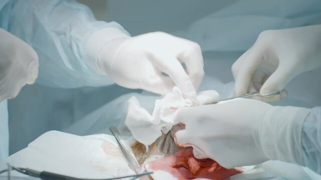 Close-up operation on male organ. Action. Bloody operation on male sexual organ. Treatment, fracture and enlargement of male genital organ. Penis Surgery