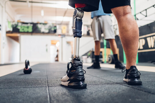 Man with prosthetic leg and friend in gym