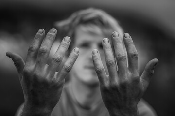 Man showing dirt covered nails and wounded fingers