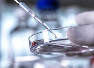 Scientist pipetting sample into a petri dish containing cells during an experiment in the laboratory.