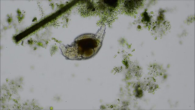 Bdelloid Rotifer