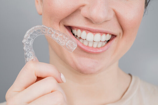 Close-up portrait of a woman holding a plastic transparent retainer. A girl corrects a bite with the help of an orthodontic device