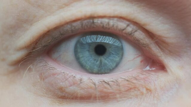 dilated pupil of human eye narrows close up.