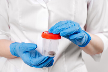 container in hand.collecting feces for analysis on helminths and protozoa.mandatory studies for children and for hospitalization aimed at detecting parasites living in the lower gastrointestinal tract