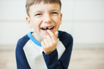 Little boy lost his first milk tooth.